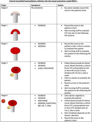 The Impact of the Introduction of Innovative REDS Scale for the Evaluation of Central Tunnelled Catheter (CTC) Exit Site on Infection Prevention in Long-Term Haemodialyzed Patients